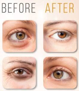 Eyeliss™ peptide powder blend for eye puffiness and dark circles