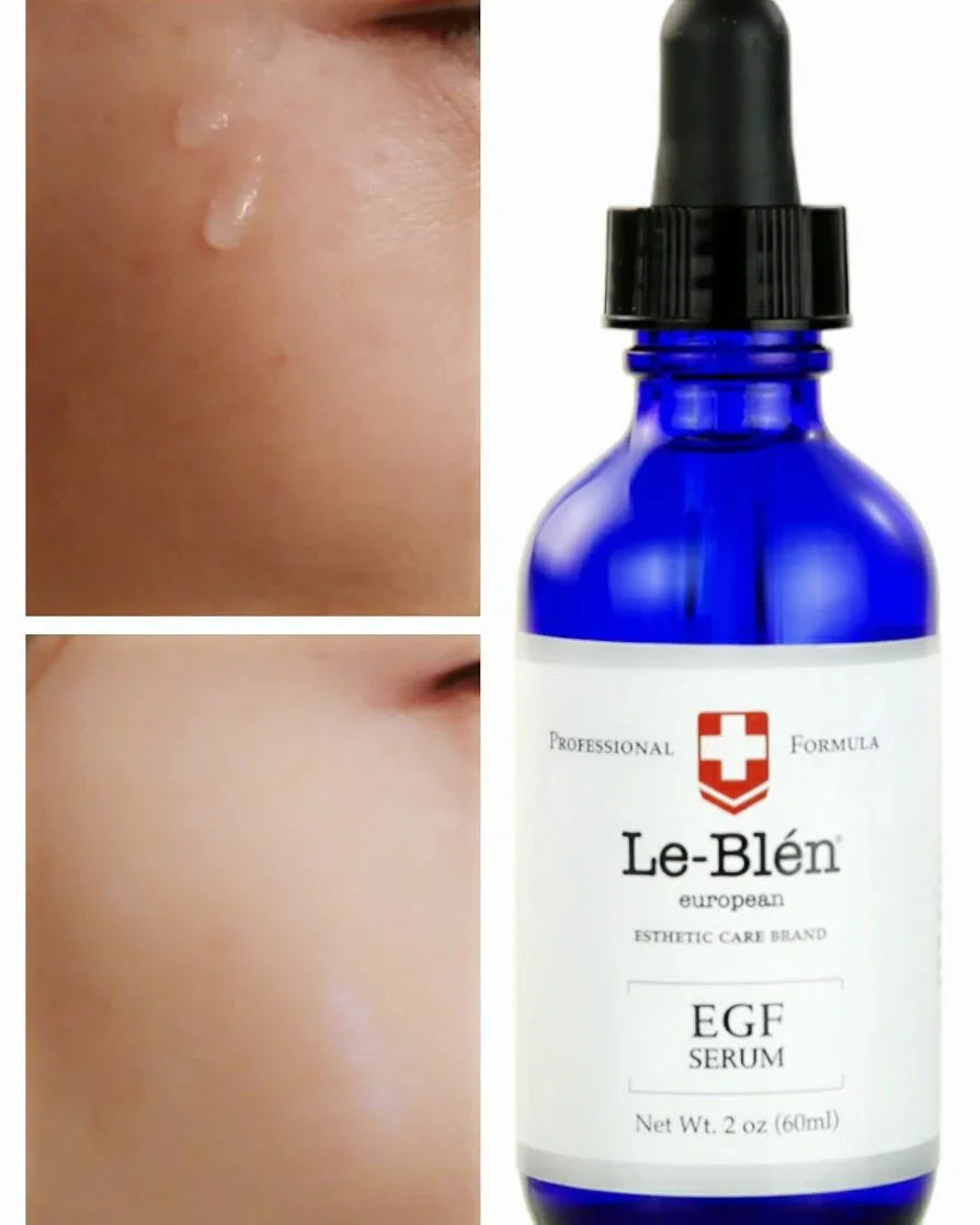 [Le Blen] EGF (Epidermal Growth Factor) Serum ( 1oz)